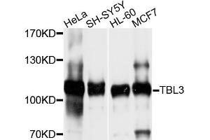 Western blot analysis of extracts of various cell lines, using TBL3 antibody (ABIN4905375) at 1:1000 dilution. (TBL3 anticorps)