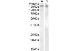 ABIN334355 (0. (AVPR1B anticorps  (Internal Region))