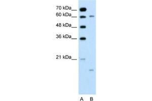 Western Blotting (WB) image for anti-Cytochrome P450, Family 4, Subfamily A, Polypeptide 22 (CYP4A22) antibody (ABIN2462485) (CYP4A22 anticorps)