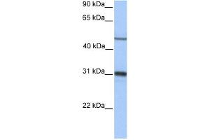 WB Suggested Anti-EPHX1 Antibody Titration: 0. (EPHX1 anticorps  (Middle Region))