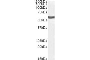 (ABIN334455) (1 μg/mL) staining of Human Kidney lysate (35 μg protein in RIPA buffer).