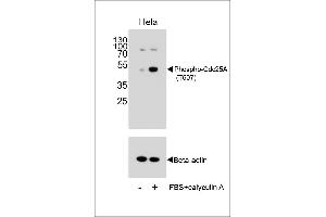 Western blot analysis of extracts from Hela cells, untreated or treated with calyculin A, using Phospho-Cdc25A Antibody .