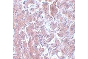 Immunohistochemistry (IHC) image for anti-ELOVL Fatty Acid Elongase 7 (ELOVL7) (N-Term) antibody (ABIN1031366) (ELOVL7 anticorps  (N-Term))