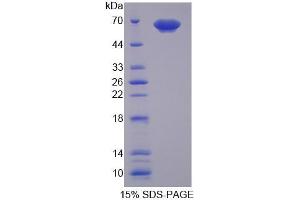 SDS-PAGE analysis of Human PUF60 Protein. (PUF60 Protéine)