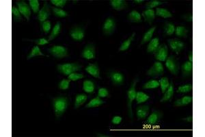Image no. 2 for anti-CLK3 (CLK3) (AA 36-136) antibody (ABIN598614) (CLK3 anticorps  (AA 36-136))