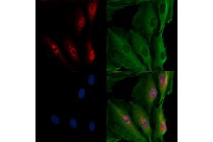ABIN7094490 and ABIN7098539 staining  cells by IF/ICC. (Transportin 1 anticorps  (C-Term))