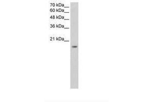 Image no. 2 for anti-Zinc Finger Protein 580 (ZNF580) (AA 31-80) antibody (ABIN6736331) (ZNF580 anticorps  (AA 31-80))
