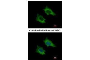 ICC/IF Image Immunofluorescence analysis of methanol-fixed HeLa, using PRPSAP2, antibody at 1:500 dilution. (PRPSAP2 anticorps)