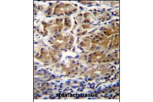 PDPR Antibdy (C-term) (ABIN655953 and ABIN2845339) immunohistochemistry analysis in formalin fixed and paraffin embedded human stomach tissue followed by peroxidase conjugation of the secondary antibody and DAB staining. (PDPR anticorps  (C-Term))