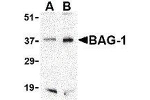 Western Blotting (WB) image for anti-BCL2-Associated Athanogene (BAG1) (C-Term) antibody (ABIN2477576)