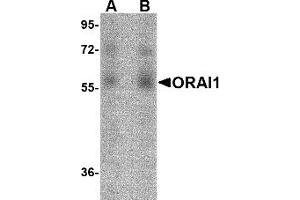 Western Blotting (WB) image for anti-ORAI Calcium Release-Activated Calcium Modulator 1 (ORAI1) (C-Term) antibody (ABIN492545) (ORAI1 anticorps  (C-Term))