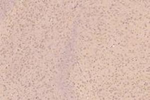 Immunohistochemistry analysis of paraffin-embedded mouse substantia nigra using KIF5B (ABIN7074440) at dilution of 1: 1000