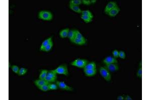 Immunofluorescent analysis of HepG2 cells using ABIN7172795 at dilution of 1:100 and Alexa Fluor 488-congugated AffiniPure Goat Anti-Rabbit IgG(H+L)