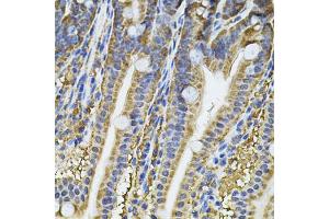 Immunohistochemistry of paraffin-embedded mouse intestine using NFU1 Antibody (ABIN2564134) at dilution of 1:100 (40x lens). (NFU1 anticorps)