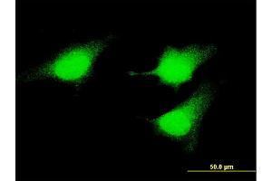 Immunofluorescence of monoclonal antibody to MAP2K5 on HeLa cell. (MAP2K5 anticorps  (AA 1-120))
