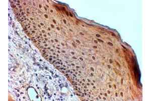 ABIN185539 (2µg/ml) staining of paraffin embedded Human Skin.