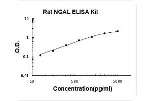 Lipocalin 2 (LCN2) ELISA Kit