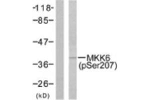 Image no. 1 for anti-Mitogen-Activated Protein Kinase Kinase 6 (MAP2K6) (pSer207) antibody (ABIN318071) (MAP2K6 anticorps  (pSer207))
