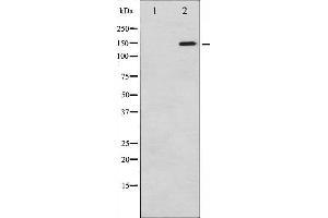 Western blot analysis of PLCG1 phosphorylation expression in EGF treated COS7 whole cell lysates,The lane on the left is treated with the antigen-specific peptide.