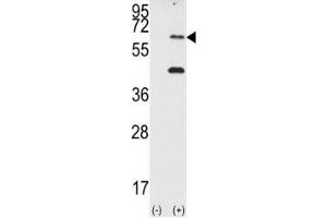 Western blot analysis of PKR antibody and 293 cell lysate (2 ug/lane) either nontransfected (Lane 1) or transiently transfected with the EIF2AK2/PKR gene (2).