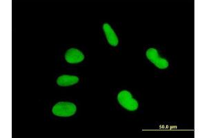 Immunofluorescence of purified MaxPab antibody to ZNF92 on HepG2 cell.