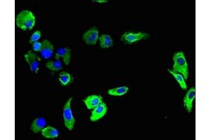 Immunofluorescent analysis of HepG2 cells using ABIN7163576 at dilution of 1:100 and Alexa Fluor 488-congugated AffiniPure Goat Anti-Rabbit IgG(H+L)