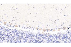 Detection of MAN1A1 in Human Cerebellum Tissue using Polyclonal Antibody to Mannosidase Alpha Class 1A Member 1 (MAN1A1)