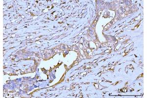IHC analysis of GNB3 using anti-GNB3 antibody (ABIN7599726).