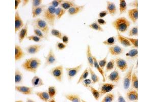 ICC testing of HeLa cells (DCI anticorps  (C-Term))