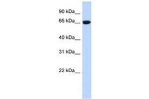 Image no. 1 for anti-GTP Binding Protein 2 (GTPBP2) (AA 35-84) antibody (ABIN6740772) (GTPBP2 anticorps  (AA 35-84))
