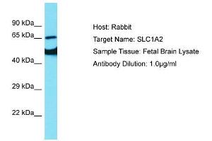 Host:  Rabbit  Target Name:  SLC1A2  Sample Type:  Fetal Brain lysates  Antibody Dilution:  1. (SLC1A2 anticorps  (N-Term))