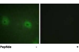 Immunofluorescence analysis of HUVEC cells, using STAM2 polyclonal antibody . (STAM2 anticorps)