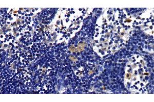 Detection of IL1R1 in Rat Lymph node Tissue using Polyclonal Antibody to Interleukin 1 Receptor Type I (IL1R1)