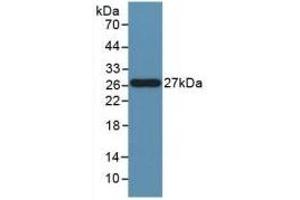 Detection of Recombinant FASL, Human using Polyclonal Antibody to Factor Related Apoptosis Ligand (FASL)