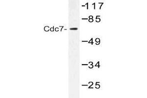 Western blot (WB) analysis of Cdc7 antibody in extracts from Jurkat cells. (CDC7 anticorps)
