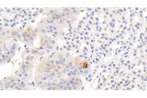 anti-C-Myc Binding Protein (MYCBP) (AA 2-103) antibody