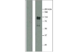 Western Blotting (WB) image for anti-Fibrinogen (citrullinated) antibody (ABIN1107223) (Fibrinogen anticorps  (citrullinated))
