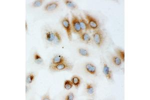 Anti-Hsp70 antibody, ICC ICC: A549 Cell (HSP70 1A anticorps  (C-Term))