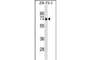Western blot analysis in ZR-75-1 cell line lysates (35ug/lane). (ZNF654 anticorps  (C-Term))