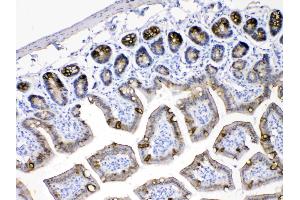 Cytokeratin 18 was detected in paraffin-embedded sections of mouse intestine tissues using rabbit anti- Cytokeratin 18 Antigen Affinity purified polyclonal antibody (Catalog # ) at 1 µg/mL.