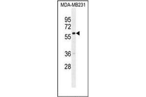 Western blot analysis of GNL3L Antibody (N-term) in MDA-MB231 cell line lysates (35ug/lane). (GNL3L anticorps  (N-Term))