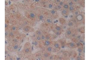 Detection of NXN in Human Liver Tissue using Polyclonal Antibody to Nucleoredoxin (NXN) (NXN anticorps  (AA 166-327))