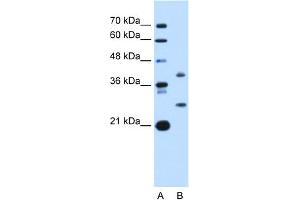 WB Suggested Anti-ST8SIA2 Antibody Titration:  1 ug/ml  Positive Control:  HepG2 cell lysate (ST8SIA2 anticorps  (C-Term))