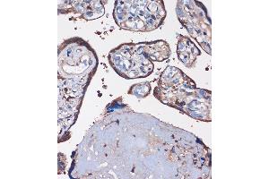 Immunohistochemistry of paraffin-embedded Human placenta using WDR61 Rabbit pAb (ABIN7271361) at dilution of 1:100 (40x lens). (WDR61 anticorps  (AA 1-305))
