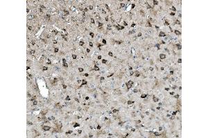 IHC analysis of Glutaminase/GLS using anti-Glutaminase/GLS antibody (ABIN7601603). (Glutaminase anticorps  (AA 396-654))