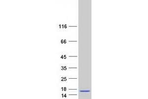 Gonadotropin-Releasing Hormone 1 (Luteinizing-Releasing Hormone) (GNRH1) (Transcript Variant 2) protein (Myc-DYKDDDDK Tag)