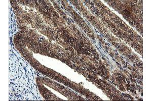 Image no. 8 for anti-Mannose Phosphate Isomerase (MPI) antibody (ABIN1499543)