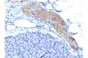 Formalin-fixed, paraffin-embedded human Pancreas stained with CD56 Mouse Monoclonal Antibody (NCAM1/795). (CD56 anticorps)