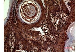 Immunohistochemistry (IHC) analysis of paraffin-embedded Human Skin, antibody was diluted at 1:100.
