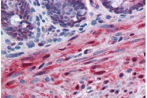 Human Colon, muscularis mucosa: Formalin-Fixed, Paraffin-Embedded (FFPE)